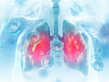 Covid-19’lu Hastalarda Akciğer Embolisi Riski Artıyor