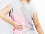 Osteoporoz (Kemik Erimesi)