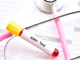 AMH Testi ile Doğurganlığınızı Ölçün