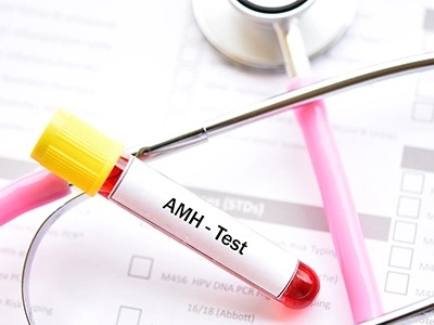 AMH Testi ile Doğurganlığınızı Ölçün