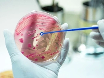 Sepsis Nedir? Sepsis Nedir?