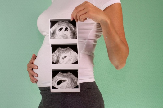 Trimester Dönemleri: Hamilelik Süreci Rehberi Trimester Dönemleri: Hamilelik Süreci Rehberi