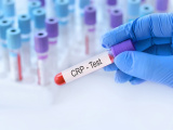 CRP ve CRP Testi Nedir?