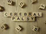 Serebral Palsi Nedir? Belirtileri, Nedenleri ve Tedavisi