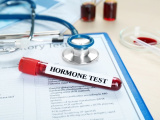 Hormon Testi Nedir? Nasıl Yapılır, Ne Zaman Yapılır, Sonuçları Ne Zaman Çıkar?