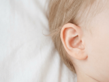 Kepçe Kulak Ameliyatı (Otoplasti) Nedir? Nasıl Yapılır ve Kimler İçin Uygundur?