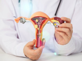 Yumurtalık Kisti Nedir? Belirtileri ve Tedavi Yöntemleri