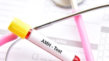 AMH Testi ile Doğurganlığınızı Ölçün AMH Testi ile Doğurganlığınızı Ölçün